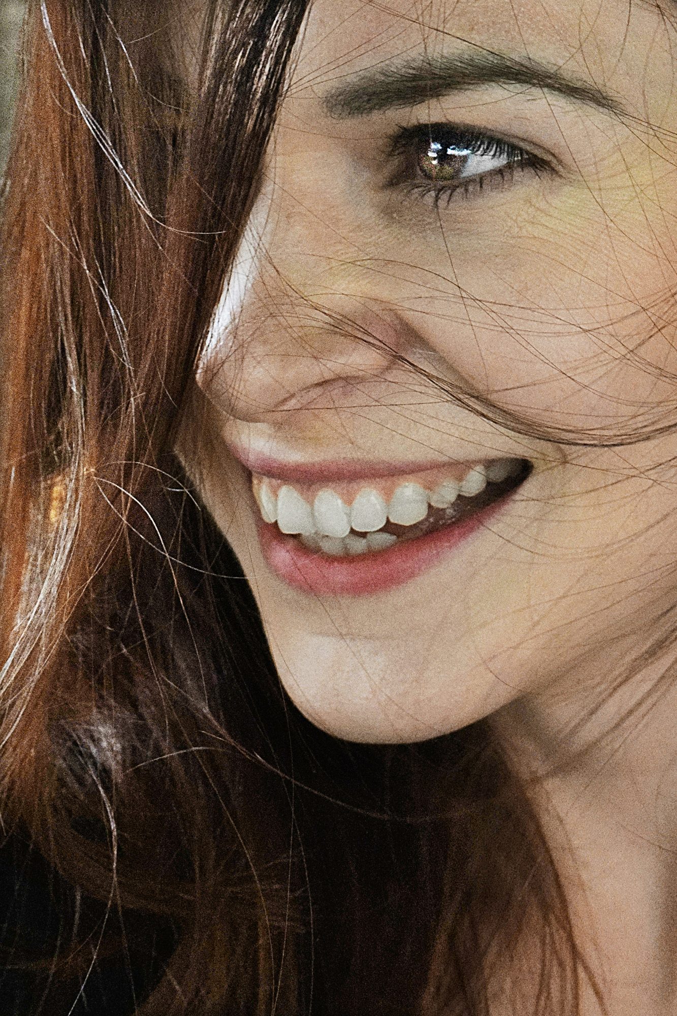 Blanqueamiento dental profesional en Dentikos Orihuela